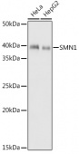 SMN1 Rabbit mAb (A9707)
