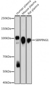 SERPING1 Rabbit mAb (A19259)