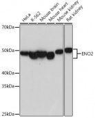 ENO2 Rabbit mAb (A19091)