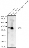 CD8A Rabbit mAb (A23081)