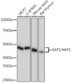 KAT1/HAT1 Rabbit mAb (A4423)