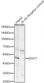 DGAT1 Rabbit mAb (A23077)