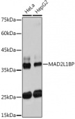 MAD2L1BP Rabbit mAb (A19600)