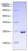 Recombinant Human IFN-alpha 4 Protein (RP00880)