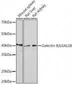 Galectin 8/LGALS8 Rabbit mAb (A4383)