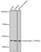 Kininogen 1 (KNG1) Rabbit mAb (A11638)