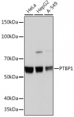 PTBP1 Rabbit mAb (A3487)