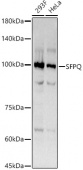 SFPQ Rabbit mAb (A3494)