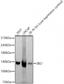 IRE1 Rabbit mAb (A21021)