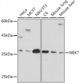 NEK7 Rabbit mAb (A19816)