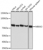 MEKK3 Rabbit mAb (A3695)