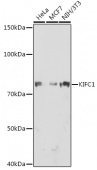 KIFC1 Rabbit mAb (A0077)