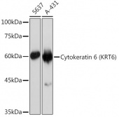 Cytokeratin 6 (KRT6) Rabbit mAb (A19827)