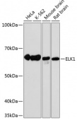ELK1 Rabbit mAb (A19046)