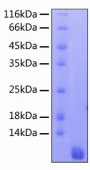 Recombinant Human CCL17/TARC Protein (RP00315)
