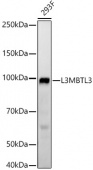 L3MBTL3 Rabbit mAb (A21932)