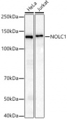 NOLC1 Rabbit mAb (A21134)