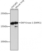 DAP Kinase 1 (DAPK1) Rabbit mAb (A11459)