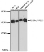 PIK3R4/VPS15 Rabbit mAb (A5922)