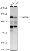 E-Cadherin Mouse mAb (A18135)