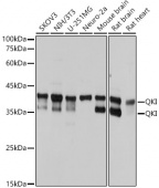 QKI Rabbit mAb (A0193)