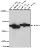 Catalase Rabbit mAb (A11220)