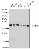 CHMP2B Rabbit mAb (A19244)