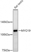 MYO19 Rabbit mAb (A20937)