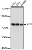 SNX1 Rabbit mAb (A3398)