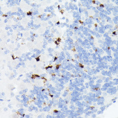 Somatostatin (SST) Rabbit mAb (A20617)