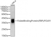 Folate Binding Protein(FBP) / FOLR1 Rabbit mAb (A22419)