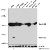 Lamin B1 Rabbit mAb (A11495)