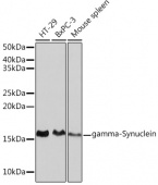 gamma-Synuclein Rabbit mAb (A2735)