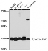Lysozyme (LYZ) Rabbit mAb (A0641)