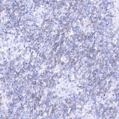 PD-1/CD279 Mouse mAb (A20217)