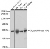 Glycerol kinase (GK) Rabbit mAb (A19221)