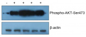 Recombinant Human EGF Protein (RP01502)