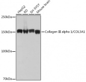 Collagen III alpha 1/COL3A1 Rabbit mAb (A0817)