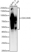 CEACAM6 Rabbit mAb (A22671)