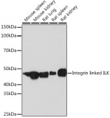 Integrin linked ILK Rabbit mAb (A4571)