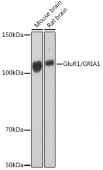 GluR1/GRIA1 Rabbit mAb (A11643)