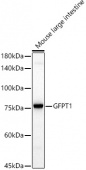 GFPT1 Rabbit mAb (A20873)