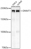 DNMT1 Rabbit mAb (A22455)