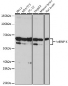 hnRNP K Rabbit mAb (A0772)
