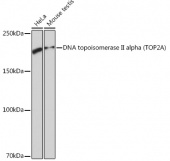 DNA topoisomerase II alpha (TOP2A) Rabbit mAb (A4389)