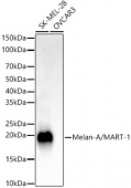 Melan-A/MART-1 Rabbit mAb (A22259)