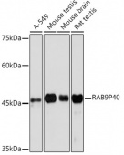 RAB9P40 Rabbit mAb (A19616)