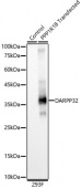 DARPP32 Rabbit mAb (A23282)