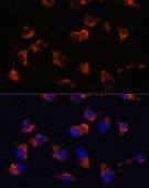 CA19-9 Mouse mAb (A17437)
