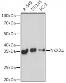 NKX3.1 Rabbit mAb (A19734)